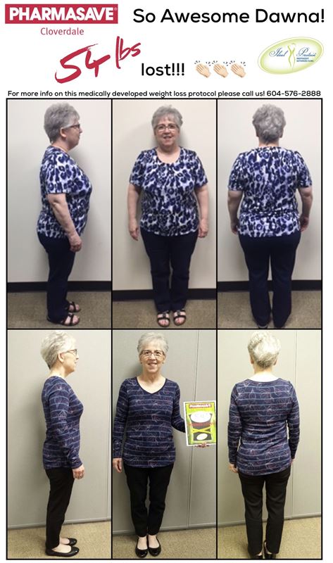 Dawna Before After 54 lbs March