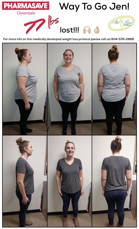 Jennifer before after 77lbs