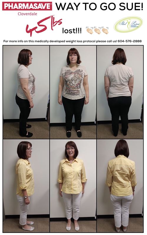 Sue Before After 45lbs July